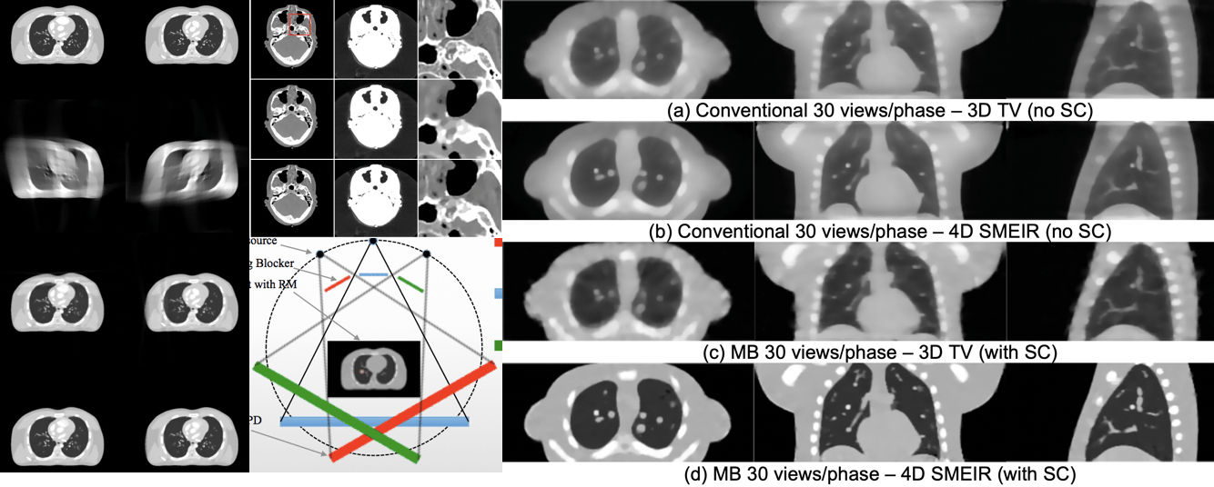 3D and 4D CT reconstruction with limited views, angle, and sparse sampling